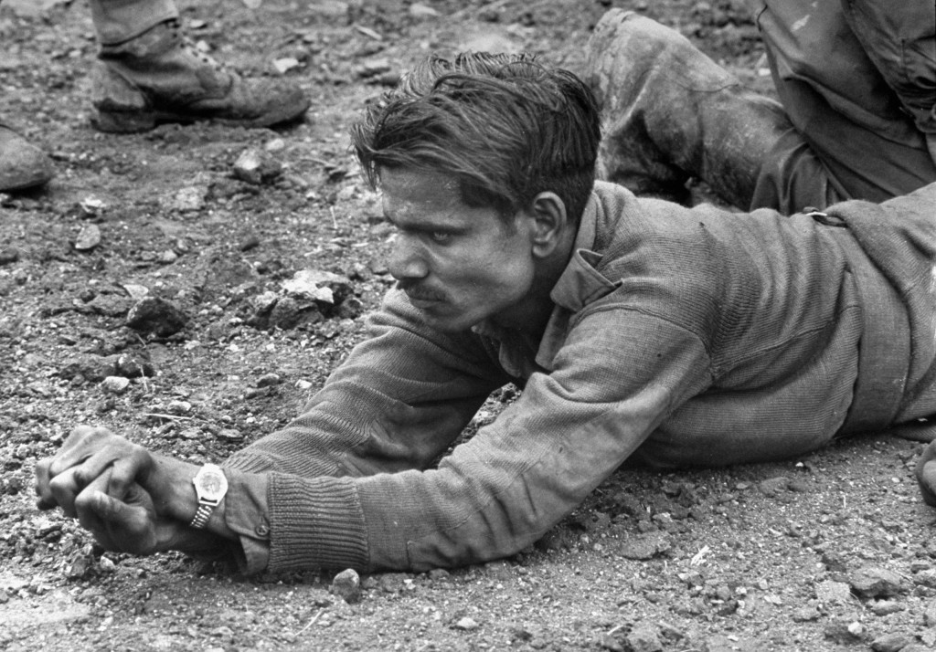 An ambulance driver from the Indian Army clenches his hands, indicating the intense pain in his leg which has been almost completely blown off